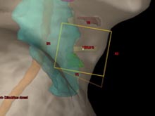 	screenshot_larynx.jpg	