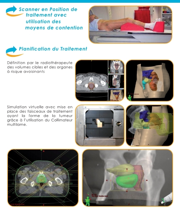 Etape de traitement d'un patient suite