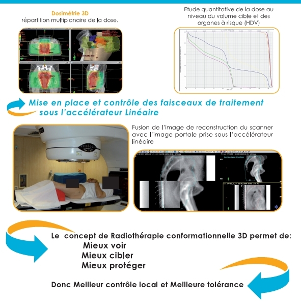 etape de traitement image